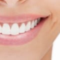 5 Essential Dental Care Tips for a Healthy Smile