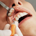 Understanding Cosmetic Dentistry: Procedures and Benefits