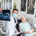 What dental care does medicaid cover?
