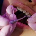 What is meant by dental care?