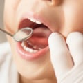 What age is free dental treatment nz?