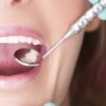 What is the best care for your teeth?
