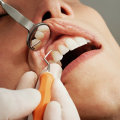 What are the Benefits Dental Health