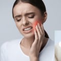 Pain Management After Tooth Extraction