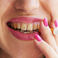 Effects Of Smoking On Teeth
