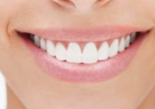 5 Essential Dental Care Tips for a Healthy Smile