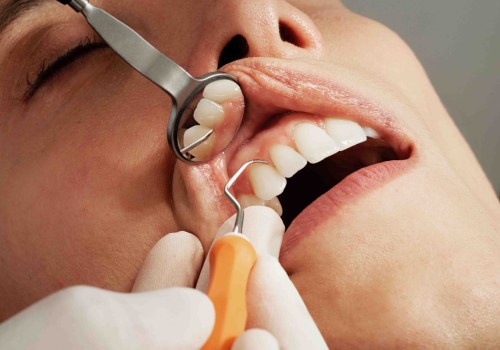 Understanding Cosmetic Dentistry: Procedures and Benefits