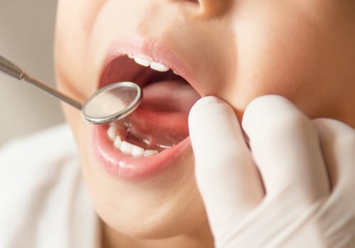 What age is free dental treatment nz?