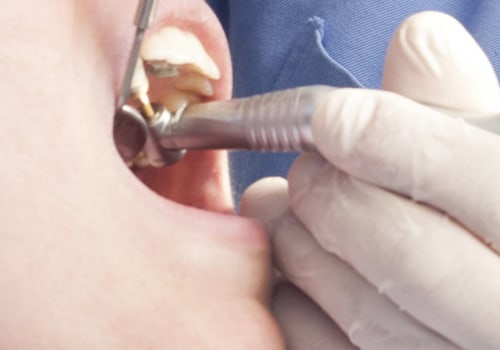 Is dental care free on universal credit?