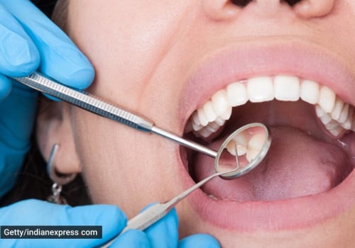 How dental health?