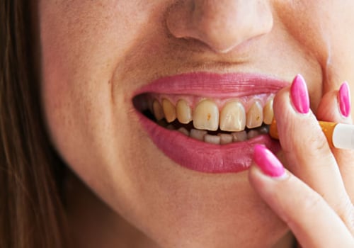 Effects Of Smoking On Teeth