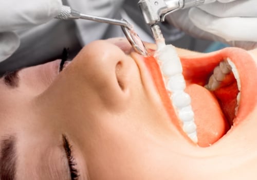Is dental care free in scotland?