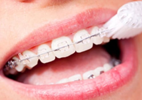 What are the Golden Rules of Dental Health